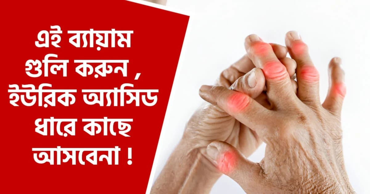 ইউরিক অ্যাসিড কমানোর ব্যায়াম